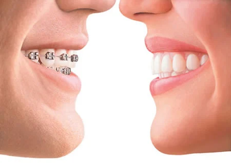 Orthodontics